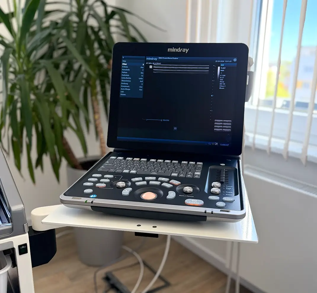 Modernes Ultraschallgerät für die Sonographie in der HNO-Praxis Maren Festner.